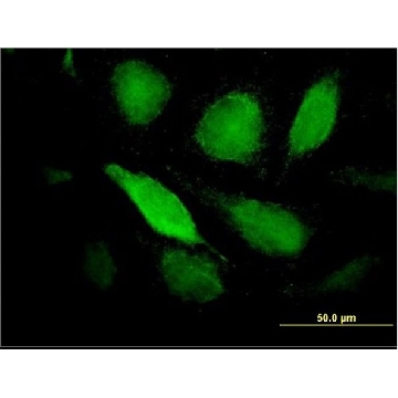 Monoclonal Anti-PTX3 antibody produced in mouse，100UG，WH0005806M2-100UG，Sigma