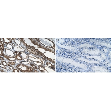 Anti-CH25H Antibody, clone 1G14 ZooMAb® Rabbit Monoclonal，25UL，ZRB2253-25UL，Sigma