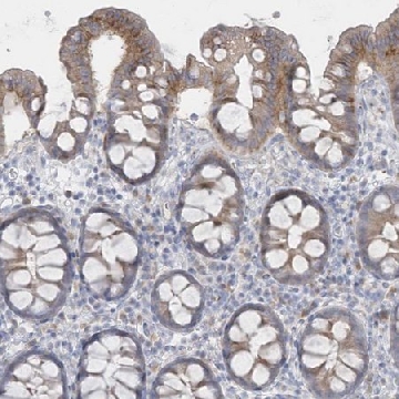 Anti-SEMA3D antibody produced in rabbit，100UL，HPA037522-100UL，Sigma