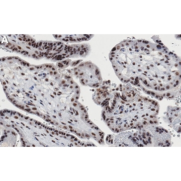 Anti-MLL2 Antibody, clone 3L17 ZooMAb® Rabbit Monoclonal，25UL，ZRB1538-25UL，Sigma
