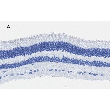 Anti-Recoverin Antibody, clone 1J23, ZooMAb® Rabbit Monoclonal，4X25UL，ZRB1107-4X25UL，Sigma