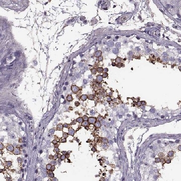 Anti-SLC2A3 antibody produced in rabbit，100UL，HPA006539-100UL，Sigma