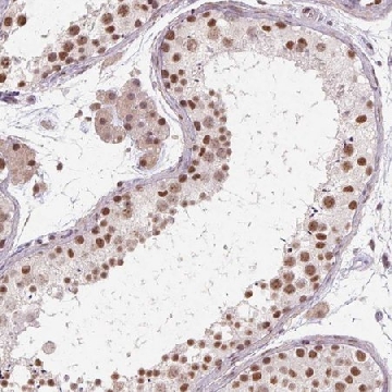Anti-CYHR1 antibody produced in rabbit，100UL，HPA053653-100UL，Sigma