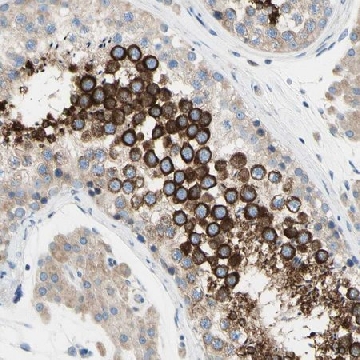 Anti-FAM134A antibody produced in rabbit，100UL，HPA011170-100UL，Sigma