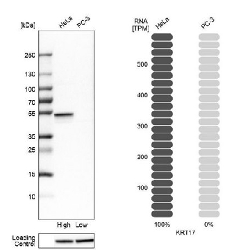 Anti-KRT17 antibody produced in rabbit，100UL，HPA000452-100UL，Sigma