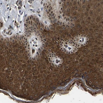 Anti-TRIM35 antibody produced in rabbit，100UL，HPA019647-100UL，Sigma