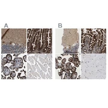 Anti-PICALM antibody produced in rabbit，100UL，HPA019053-100UL，Sigma