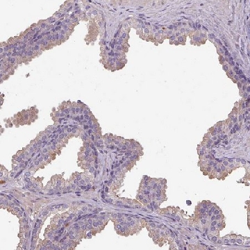 Anti-ISLR antibody produced in rabbit，100UL，HPA050811-100UL，Sigma