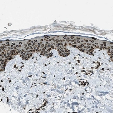 Anti-LEMD2 antibody produced in rabbit，100UL，HPA017340-100UL，Sigma