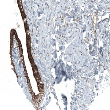 Anti-MXRA8 antibody produced in rabbit，100UL，HPA055780-100UL，Sigma