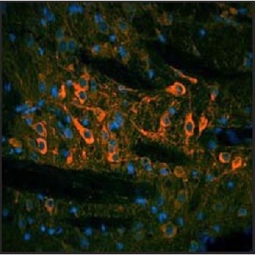 Anti-TH, (N-terminal) antibody produced in rabbit，100UL，SAB2103892-100UL，Sigma