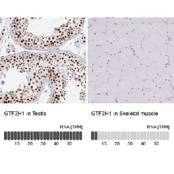 Anti-GTF2H1 antibody produced in rabbit，100UL，HPA046660-100UL，Sigma