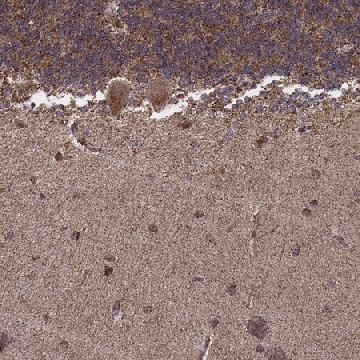 Anti-ZDHHC21 antibody produced in rabbit，100UL，HPA065254-100UL，Sigma