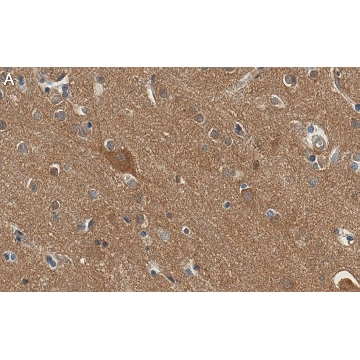 Anti-Substance P Antibody, clone 1K3 ZooMAb® Rabbit Monoclonal，25UL，ZRB1506-25UL，Sigma