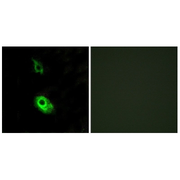 Anti-EDG3 antibody produced in rabbit，100UG，SAB4500690-100UG，Sigma