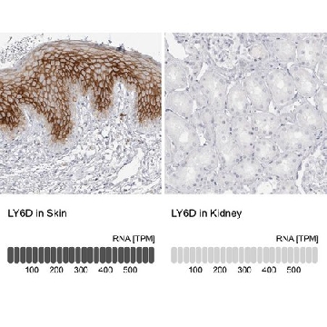 Anti-LY6D antibody produced in rabbit，100UL，HPA024755-100UL，Sigma