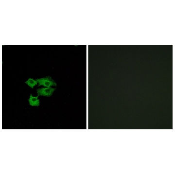 Anti-LY6E antibody produced in rabbit，100UG，SAB4501790-100UG，Sigma