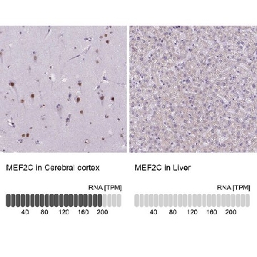 Anti-MEF2C antibody produced in rabbit，100UL，HPA005533-100UL，Sigma