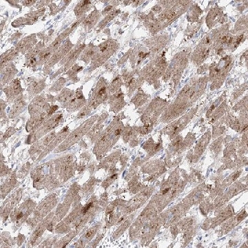 Anti-GPAT2 antibody produced in rabbit，100UL，HPA036841-100UL，Sigma