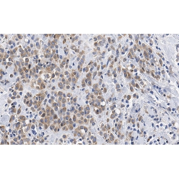 Anti-phospho-GSK-3α Ser21 Antibody, clone 1E22 ZooMAb® Rabbit Monoclonal，4X25UL，ZRB1580-4X25UL，Sigma