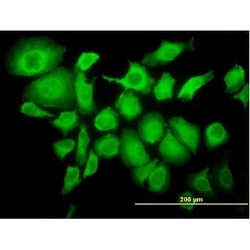 ANTI-TRIM25 antibody produced in mouse，100UG，SAB1412628-100UG，Sigma