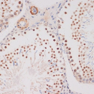 Anti-DDIT3/CHOP antibody produced in rabbit，100UL，SAB5700602-100UL，Sigma