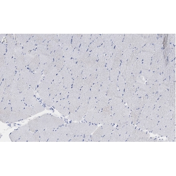 Anti-Myosin Heavy Chain 7 Antibody, clone 1B19, ZooMAb® Rabbit Monoclonal，4X25UL，ZRB1308-4X25UL，Sigma