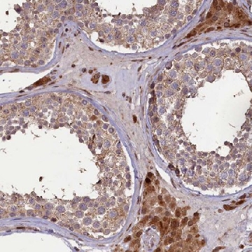 Anti-SLC38A7 antibody produced in rabbit，100UL，HPA041777-100UL，Sigma