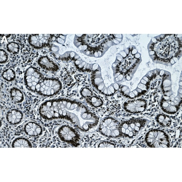 Anti-PPARα Antibody, clone 4G22 ZooMAb® Rabbit Monoclonal，4X25UL，ZRB2372-4X25UL，Sigma