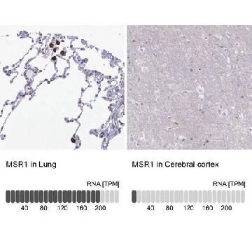 Anti-MSR1 antibody produced in rabbit，100UL，HPA000272-100UL，Sigma