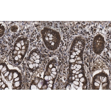 Anti-CMPK2 Antibody, clone 1M13 ZooMAb® Rabbit Monoclonal，25UL，ZRB1064-25UL，Sigma