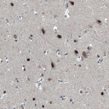 Anti-ARID5B antibody produced in rabbit，100UL，HPA015037-100UL，Sigma