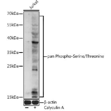 Anti-pan Phospho-Serine/Threonine antibody produced in rabbit，100UL，SAB5700525-100UL，Sigma