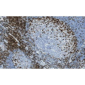 Anti-LAT Antibody, clone 2B4 ZooMAb® Rabbit Monoclonal，25UL，ZRB2033-25UL，Sigma