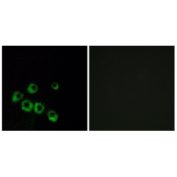 Anti-VIPR1, C-Terminal antibody produced in rabbit，100UG，SAB4503084-100UG，Sigma