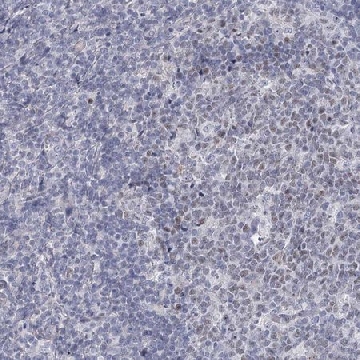 Anti-FAM76B antibody produced in rabbit，100UL，HPA036608-100UL，Sigma