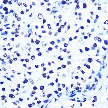Anti-Histone H2AX antibody produced in rabbit，100UL，SAB5700968-100UL，Sigma