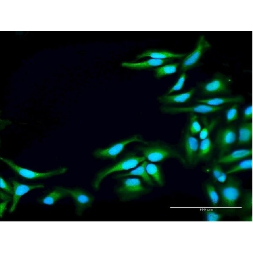 Anti-TNK2 antibody produced in rabbit，100UG，SAB1401511-100UG，Sigma