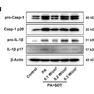 Anti-CASP1 antibody produced in rabbit，100UL，HPA003056-100UL，Sigma