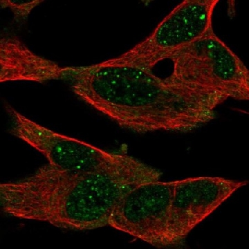 Anti-GPR155 antibody produced in rabbit，100UL，HPA057384-100UL，Sigma