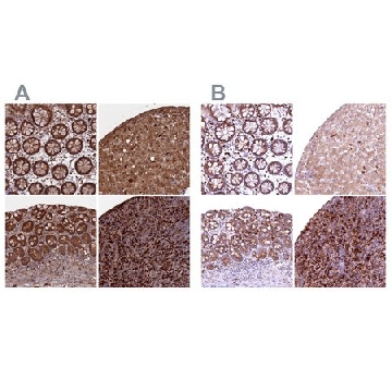Anti-BLVRB antibody produced in rabbit，100UL，HPA041698-100UL，Sigma