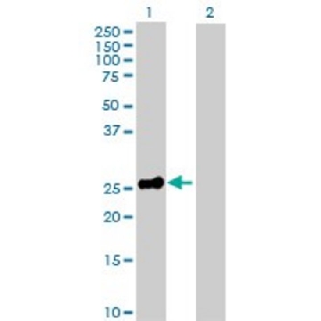 Anti-EPO antibody produced in rabbit，100UG，SAB1410344-100UG，Sigma