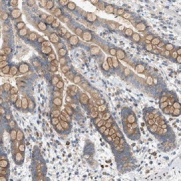 Anti-DYRK1A antibody produced in rabbit，100UL，HPA015810-100UL，Sigma