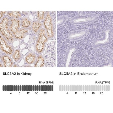 Anti-SLC5A2 antibody produced in rabbit，100UL，HPA041603-100UL，Sigma