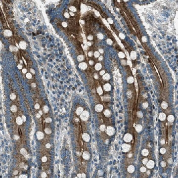 Anti-FAR1 antibody produced in rabbit，100UL，HPA017322-100UL，Sigma
