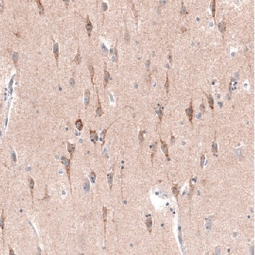 Monoclonal Anti-CTGF antibody produced in mouse，100UL，AMAB91366-100UL，Sigma
