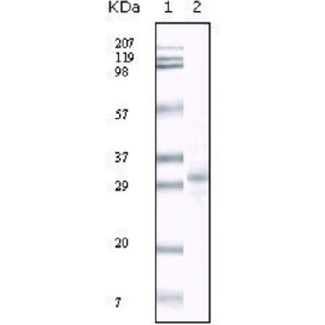 Monoclonal Anti-KSHV ORF26 antibody produced in mouse，100UL，SAB5300160-100UL，Sigma