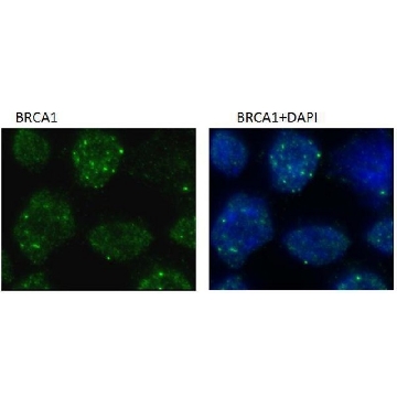 Monoclonal Anti-BRCA1 antibody produced in mouse，100UL，SAB2702136-100UL，Sigma