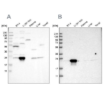 Anti-BAG2 antibody produced in rabbit，100UL，HPA018862-100UL，Sigma