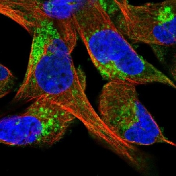 Anti-CLCN5 antibody produced in rabbit，100UL，HPA003213-100UL，Sigma